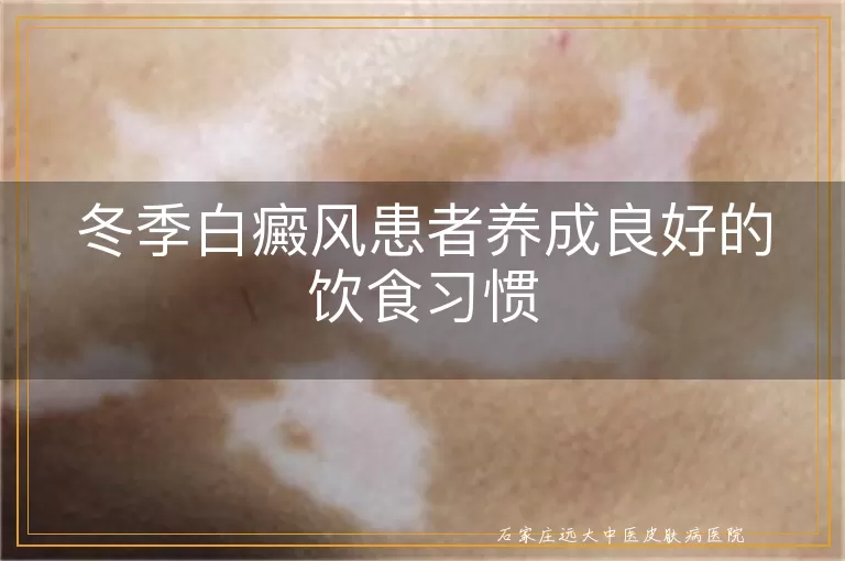 冬季白癜风患者养成良好的饮食习惯