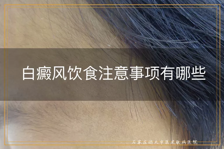白癜风饮食注意事项有哪些