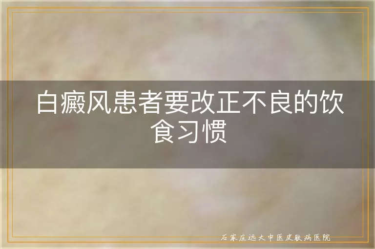 白癜风患者要改正不良的饮食习惯