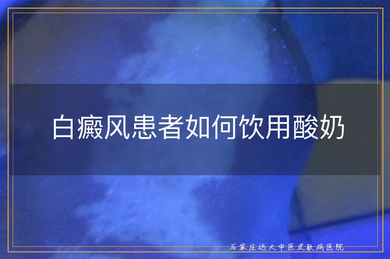 白癜风患者如何饮用酸奶
