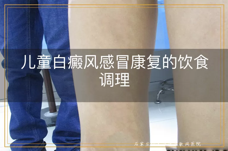 儿童白癜风感冒康复的饮食调理