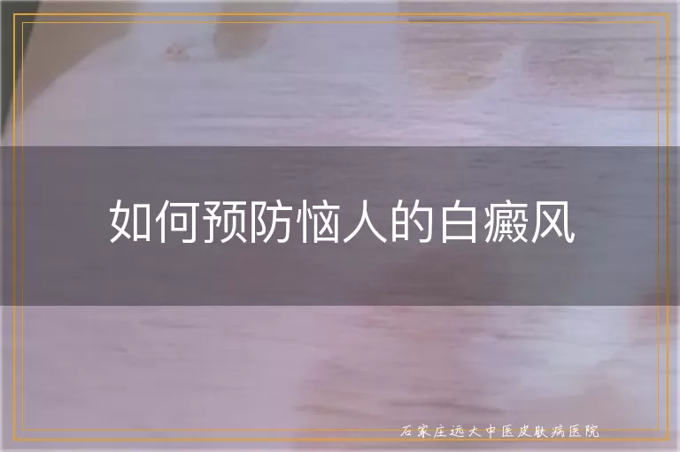 如何预防恼人的白癜风