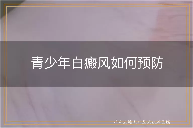 青少年白癜风如何预防