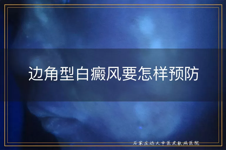 边角型白癜风要怎样预防