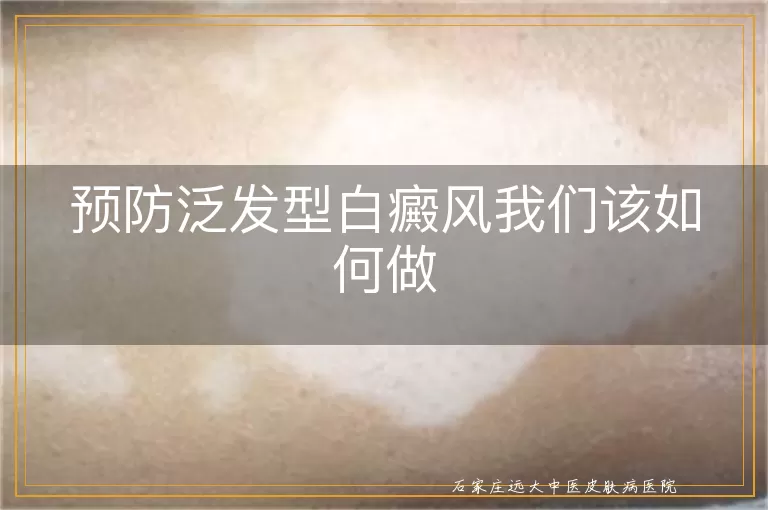 预防泛发型白癜风我们该如何做