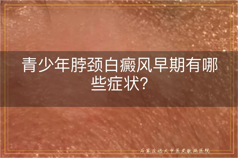 青少年脖颈白癜风早期有哪些症状？