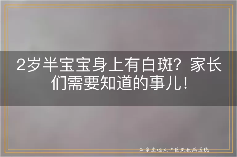 2岁半宝宝身上有白斑？家长们需要知道的事儿！