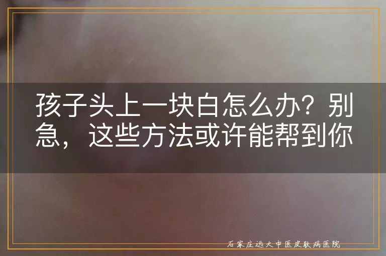 孩子头上一块白怎么办？别急，这些方法或许能帮到你！