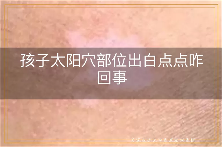 孩子太阳穴部位出白点点咋回事