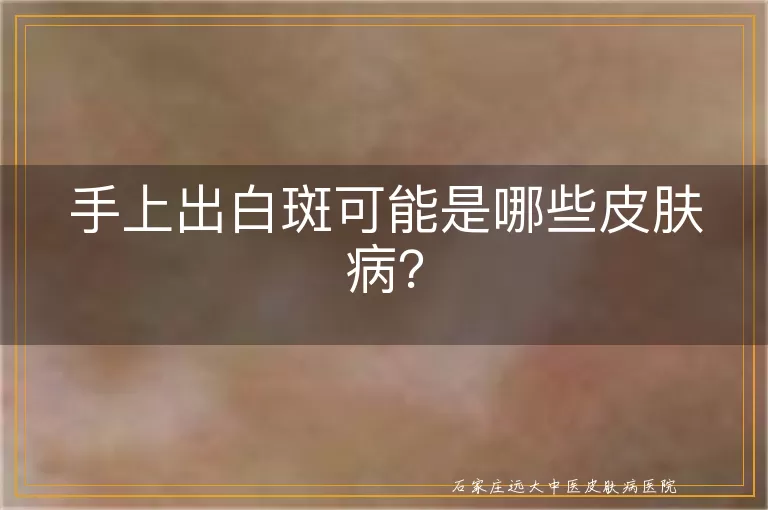 手上出白斑可能是哪些皮肤病？