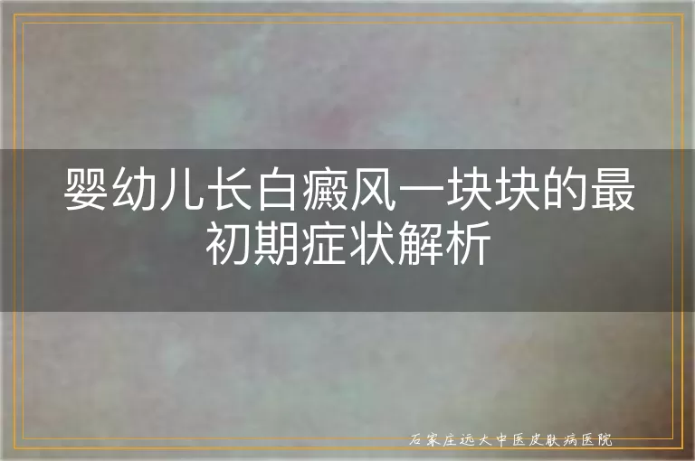 婴幼儿长白癜风一块块的最初期症状解析