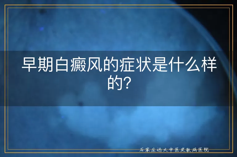 早期白癜风的症状是什么样的？