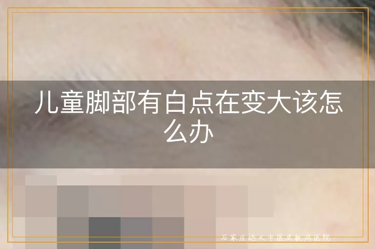 儿童脚部有白点在变大该怎么办