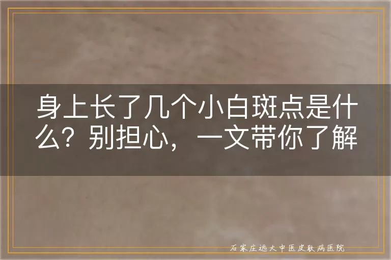 身上长了几个小白斑点是什么？别担心，一文带你了解可能的原因！