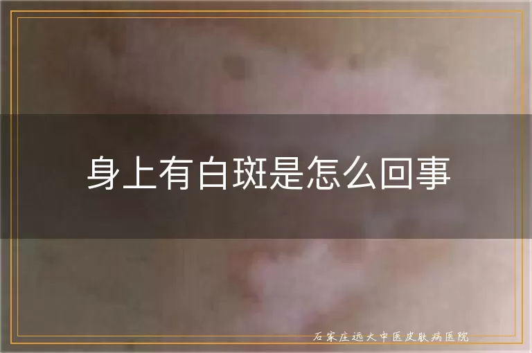 身上有白斑是怎么回事