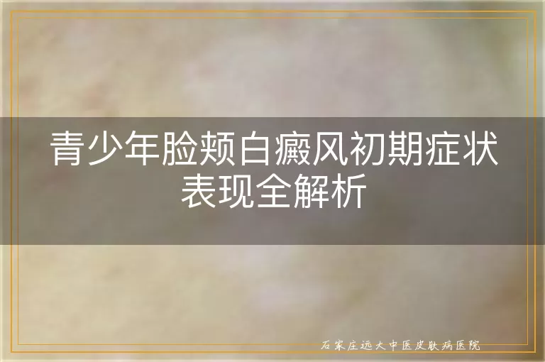 青少年脸颊白癜风初期症状表现全解析