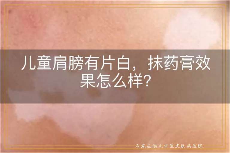 儿童肩膀有片白，抹药膏效果怎么样？