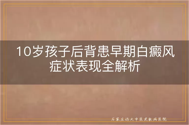 10岁孩子后背患早期白癜风症状表现全解析