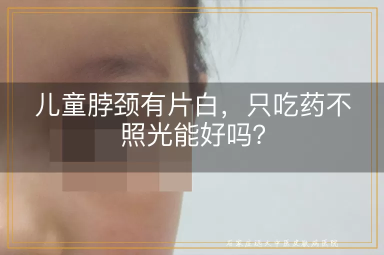 儿童脖颈有片白，只吃药不照光能好吗？