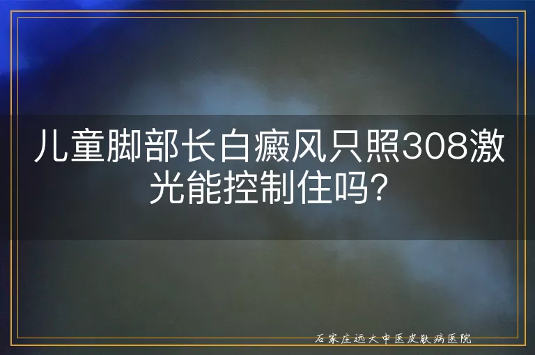 儿童脚部长白癜风只照308激光能控制住吗？