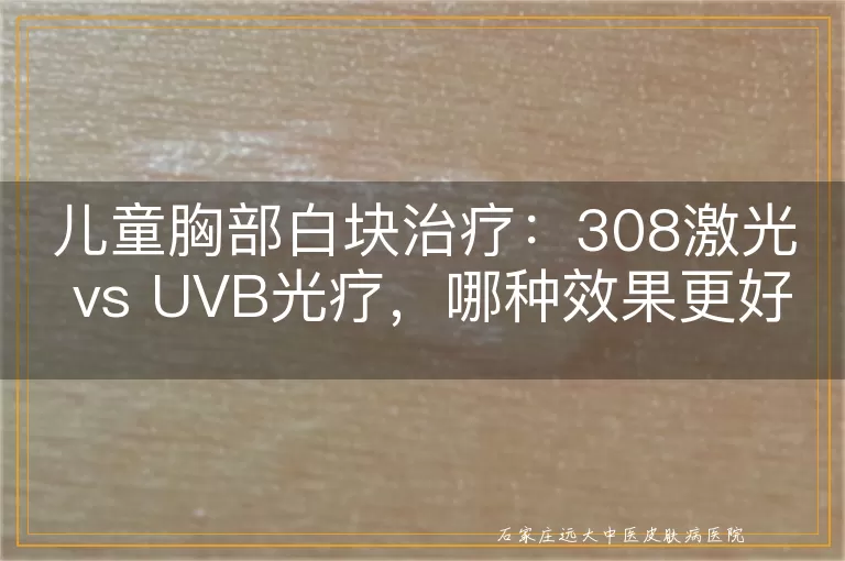 儿童胸部白块治疗：308激光 vs UVB光疗，哪种效果更好？