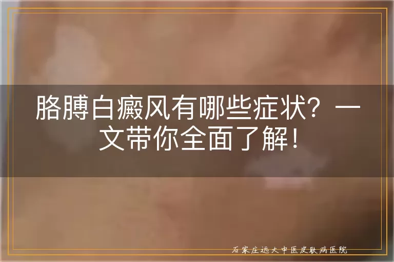 胳膊白癜风有哪些症状？一文带你全面了解！
