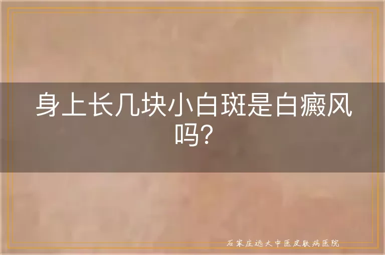 身上长几块小白斑是白癜风吗？