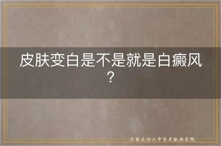 皮肤变白是不是就是白癜风？