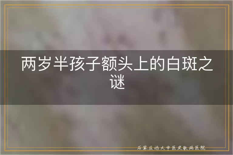 两岁半孩子额头上的白斑之谜