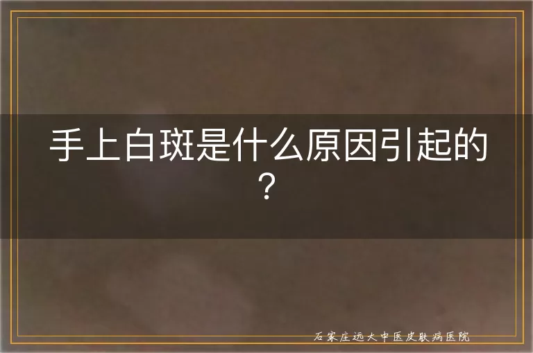 手上白斑是什么原因引起的？