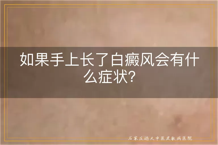 如果手上长了白癜风会有什么症状？