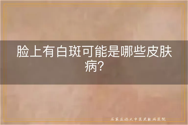 脸上有白斑可能是哪些皮肤病？