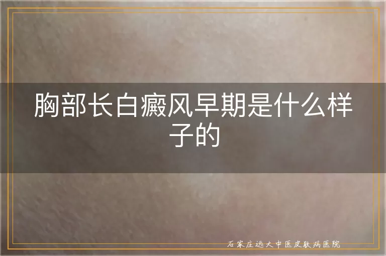 胸部长白癜风早期是什么样子的