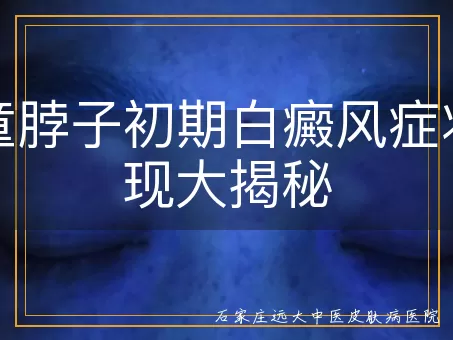儿童脖子初期白癜风症状表现大揭秘