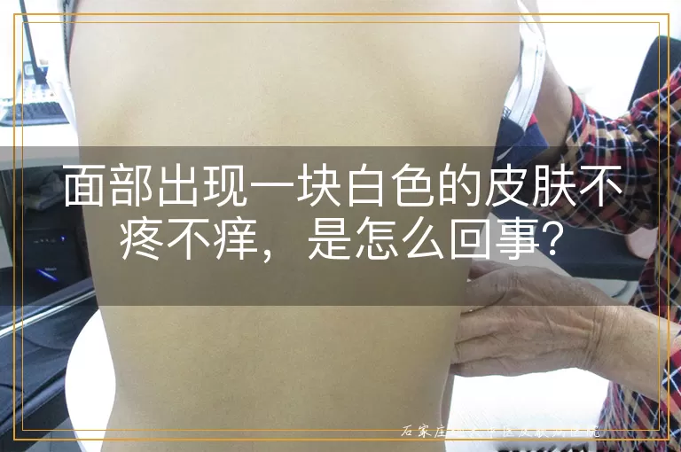 面部出现一块白色的皮肤不疼不痒，是怎么回事？