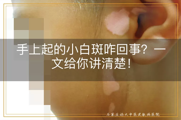 手上起的小白斑咋回事？一文给你讲清楚！