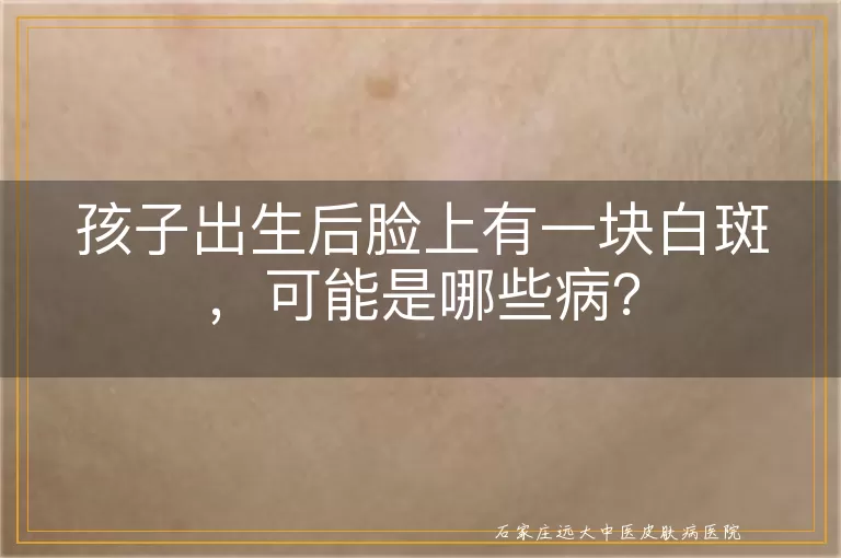 孩子出生后脸上有一块白斑，可能是哪些病？