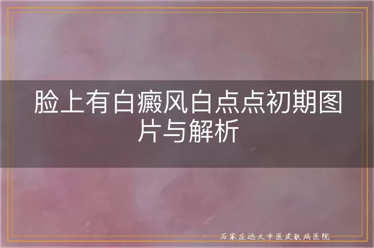 脸上有白癜风白点点初期图片与解析