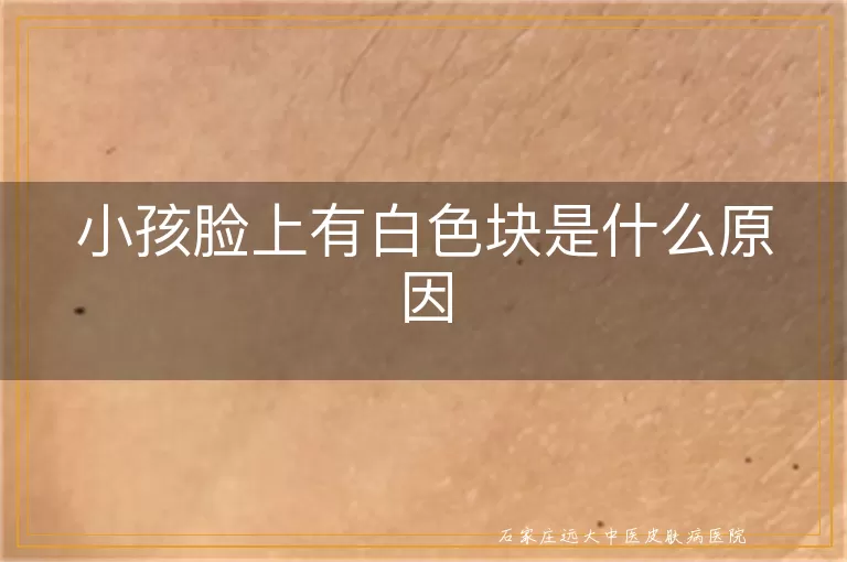 小孩脸上有白色块是什么原因