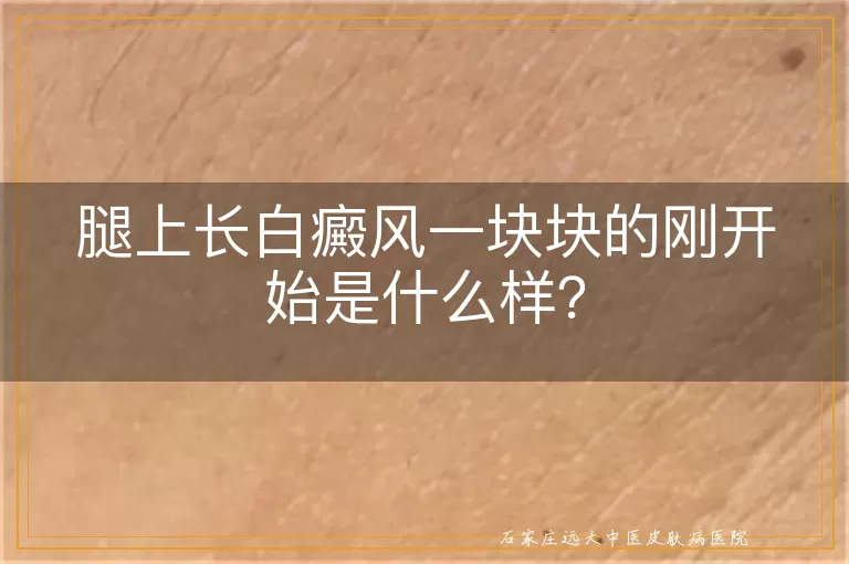 腿上长白癜风一块块的刚开始是什么样？