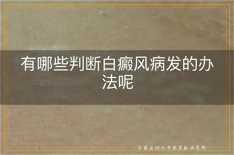有哪些判断白癜风病发的办法呢