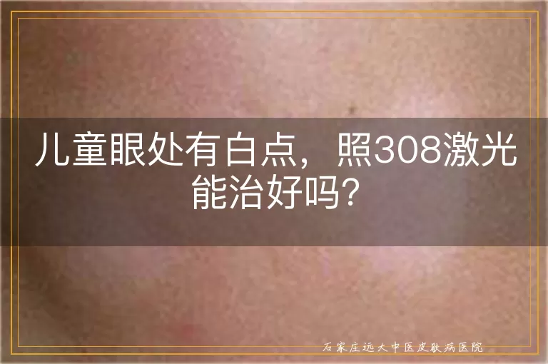 儿童眼处有白点，照308激光能治好吗？