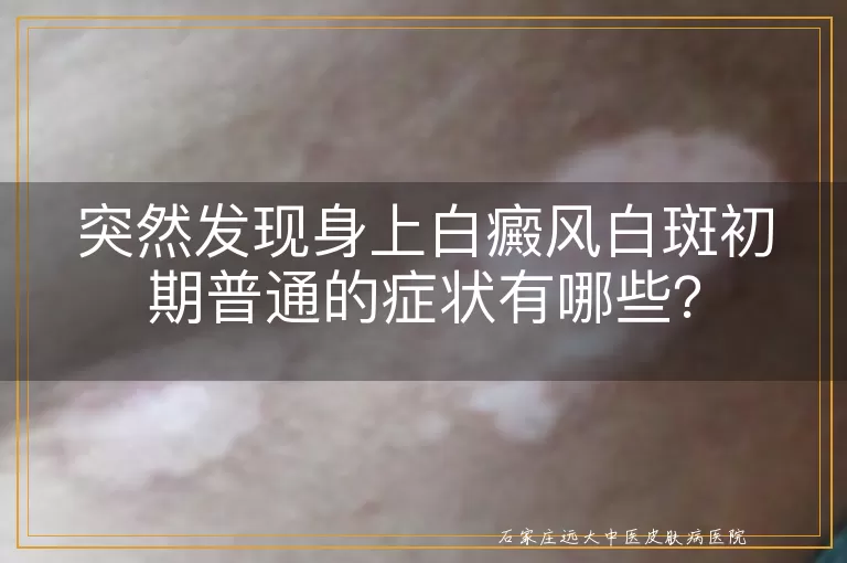 突然发现身上白癜风白斑初期普通的症状有哪些？