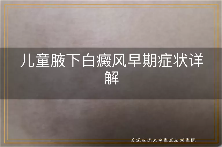 儿童腋下白癜风早期症状详解