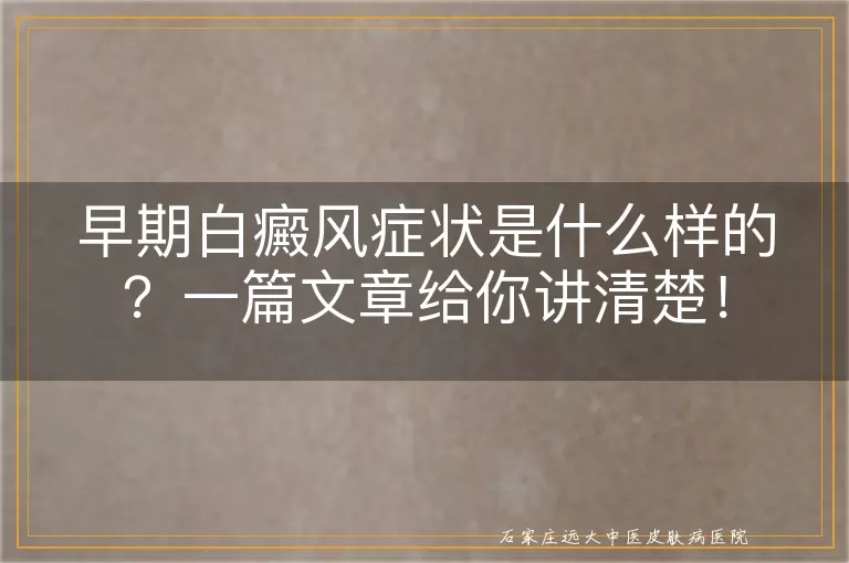 早期白癜风症状是什么样的？一篇文章给你讲清楚！