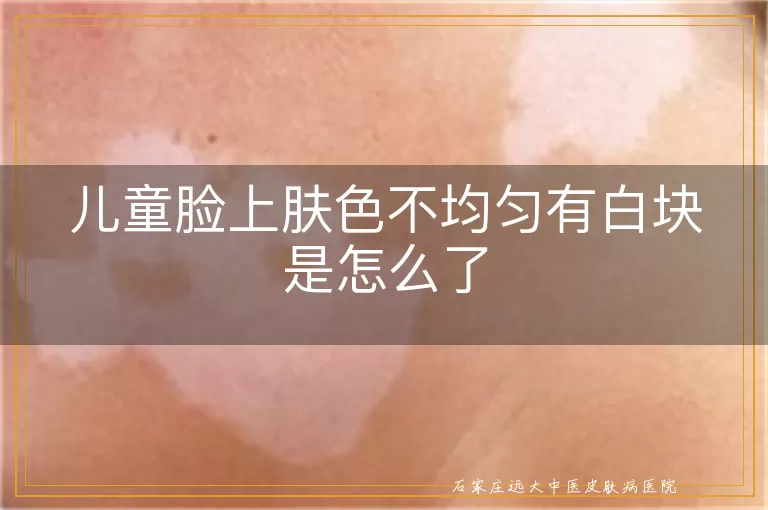 儿童脸上肤色不均匀有白块是怎么了