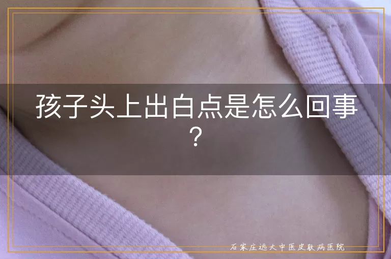 孩子头上出白点是怎么回事？