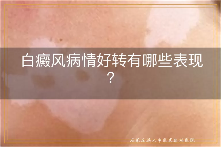 白癜风病情好转有哪些表现？
