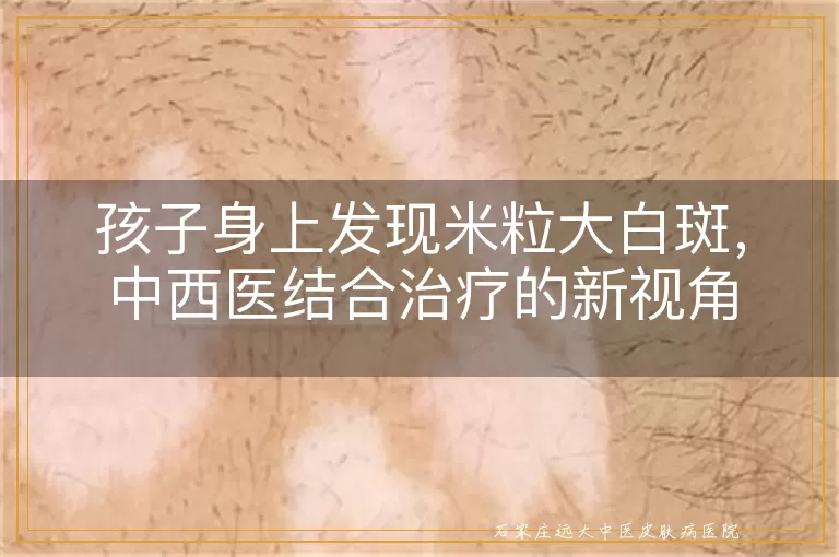 孩子身上发现米粒大白斑，中西医结合治疗的新视角