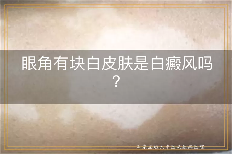 眼角有块白皮肤是白癜风吗？